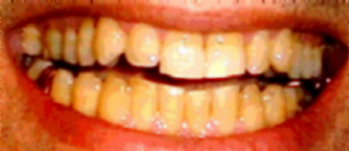 ob2.jpg (43528 bytes)