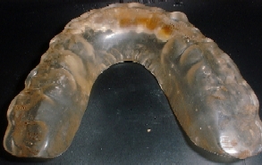 splintaa.jpg (47299 bytes)